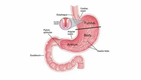 gastroparesis diet