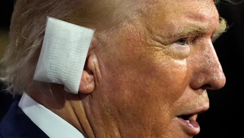 Trump ear wound